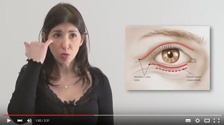 Vidéo : blépharoplastie Vidéo : blépharoplastie