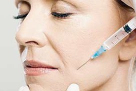 Comblement des sillons naso géniens par injection d'acide hyaluronique