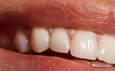 Sourire Parfait & Esthétique du Visage - Dr Laurence Benouaiche | Paris
