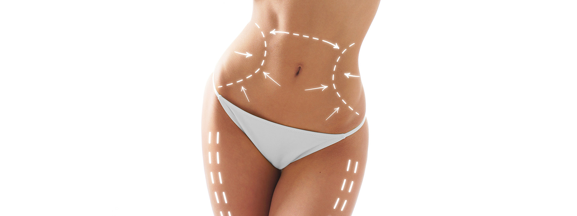 Lipofilling silhouette - Dr Benouaiche - Paris