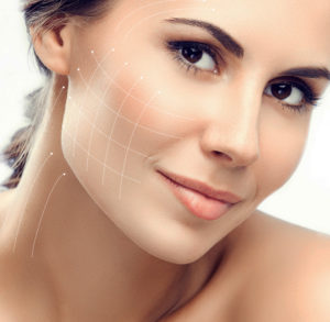 Resorbable silhouette soft threads - Dr Benouaiche - Paris