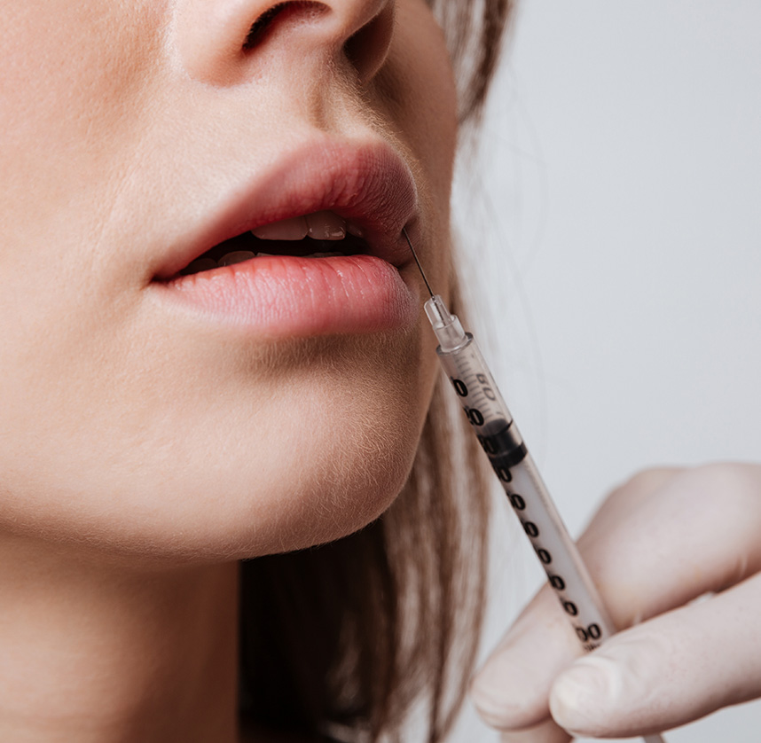 Hyaluronic acid injections in the lips | Dr Benouaiche