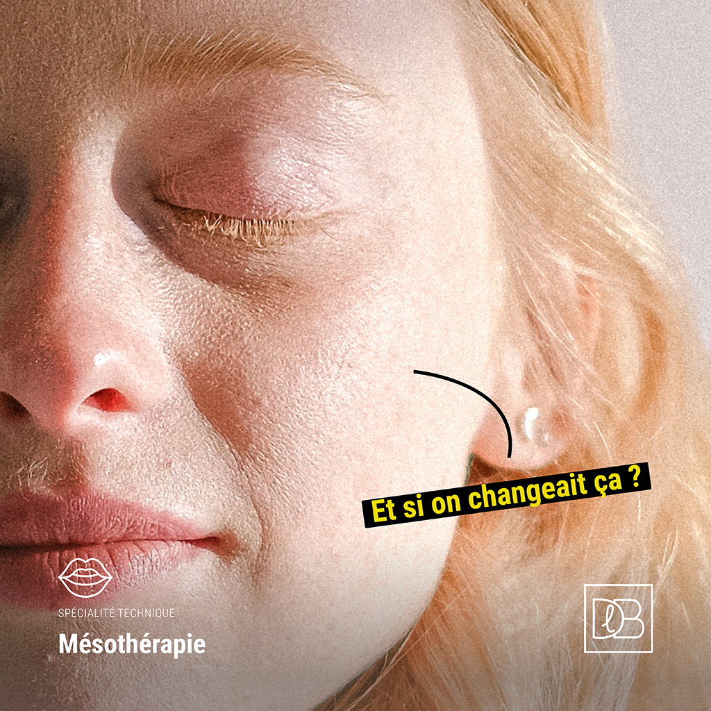 Mésothérapie : hydratation de la peau du visage - Docteur Benouaiche, Paris